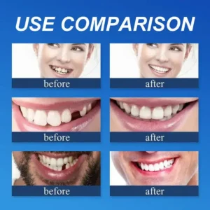 OEOMON™ Medical Full Denture with Strong Suctiond Custom-Fit Full Functional Dentures