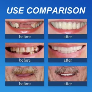 OEOMON™ Medical Full Denture with Strong Suctiond Custom-Fit Full Functional Dentures