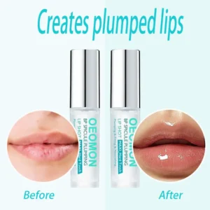 OEOMON™ Skip the Clinic! 🚫💉 Get Fuller Lips Instantly 💋
