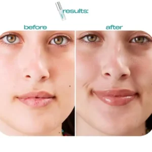 OEOMON™ Skip the Clinic! 🚫💉 Get Fuller Lips Instantly 💋