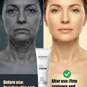 🏆Flash Sale⚡OEOMON™ Collagen Fullerene Neck Cream – Elevate Your Neck Care Routine ✨